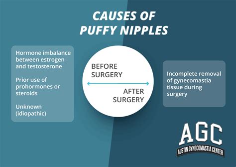 puffed niples|Nipple Problems: Causes, Diagnosis and Treatments .